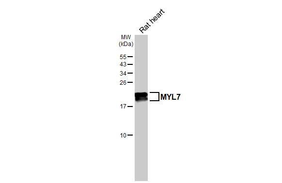 Rat tissue extract (50 ug) was separated by 15% SDS-PAGE, and the membrane was blotted with MYL7 antibody (NBP2-19449) diluted at 1:10000. The HRP-conjugated anti-rabbit IgG antibody  was used to detect the primary antibody. 