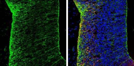 N-Cadherin antibody detects N-Cadherin protein expression by immunohistochemical analysis.Sample: Frozen sectioned E13.5 Rat brain. Green: N-Cadherin protein stained by N-Cadherin antibody (NBP2-19457) diluted at 1:250.Red: beta Tubulin 3/ TUJ1, a mature neuron marker, stained by beta Tubulin 3/ TUJ1 antibody [GT11710]  diluted at 1:500.Blue: Fluoroshield with DAPI . 