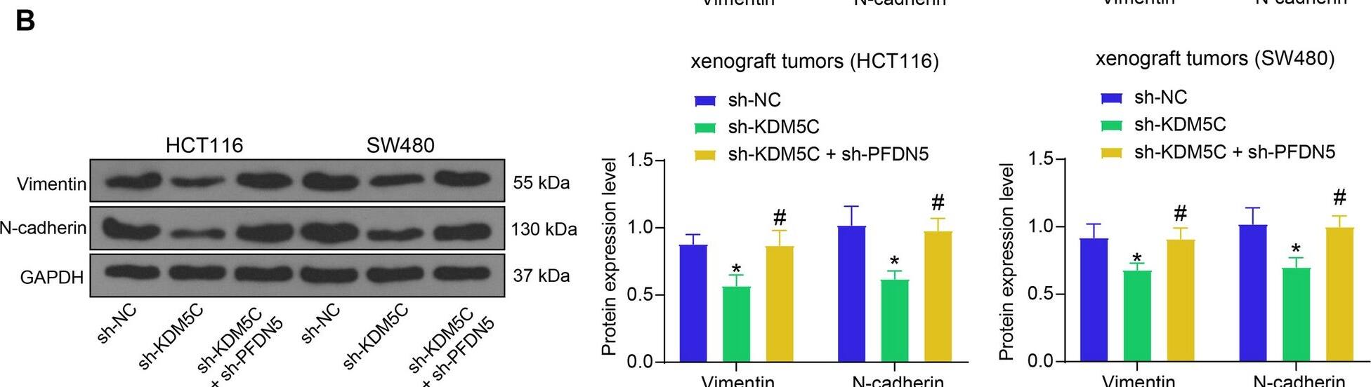 KDM5C/PFDN5 affects EMT in CRC. A protein levels of Vimentin and N-cadherin in HCT116 and SW480 cells determined by WB analysis (two-way ANOVA); B protein levels of Vimentin and N-cadherin in xenograft tumors determined by western blot analysis (two-way ANOVA). For cellular experiments, three biological replicates were performed. For animal studies, n = 5 in each group. *p < 0.05 vs. the sh-NC group; #p < 0.05 vs. the sh-KDM5C group Image collected and cropped by CiteAb from the following open publication (//molmed.biomedcentral.com/articles/10.1186/s10020-023-00775-7), licensed under a CC-BY license. Not internally tested by Novus Biologicals.