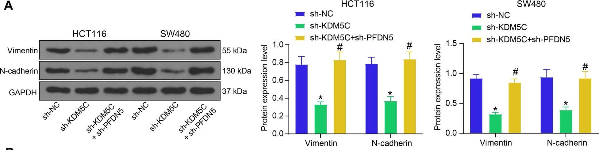 KDM5C/PFDN5 affects EMT in CRC. A protein levels of Vimentin and N-cadherin in HCT116 and SW480 cells determined by WB analysis (two-way ANOVA); B protein levels of Vimentin and N-cadherin in xenograft tumors determined by western blot analysis (two-way ANOVA). For cellular experiments, three biological replicates were performed. For animal studies, n = 5 in each group. *p < 0.05 vs. the sh-NC group; #p < 0.05 vs. the sh-KDM5C group Image collected and cropped by CiteAb from the following open publication (//molmed.biomedcentral.com/articles/10.1186/s10020-023-00775-7), licensed under a CC-BY license. Not internally tested by Novus Biologicals.