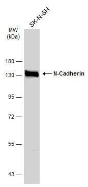 Whole cell extract (30 ug) was separated by 7.5% SDS-PAGE, and the membrane was blotted with N-Cadherin antibody (NBP2-19457) diluted at 1:1000. The HRP-conjugated anti-rabbit IgG antibody  was used to detect the primary antibody. 