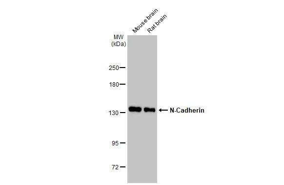 Various tissue extracts (50 ug) were separated by 5% SDS-PAGE, and the membrane was blotted with N-Cadherin antibody (NBP2-19457) diluted at 1:5000. The HRP-conjugated anti-rabbit IgG antibody  was used to detect the primary antibody. 