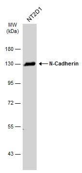 Whole cell extract (30 ug) was separated by 7.5% SDS-PAGE, and the membrane was blotted with N-Cadherin antibody (NBP2-19457) diluted at 1:1000. The HRP-conjugated anti-rabbit IgG antibody  was used to detect the primary antibody. 