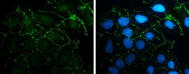 N-Cadherin antibody [N1N3] detects N-Cadherin protein at cell membrane by immunofluorescent analysis.Sample: NT2D1 cells were fixed in 4% paraformaldehyde at RT for 15 min.Green: N-Cadherin stained by N-Cadherin antibody [N1N3] (NBP2-19459) diluted at 1:500.Blue: Hoechst 33342 staining. 