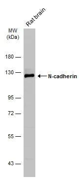 Rat tissue extract (50 ug) was separated by 7.5% SDS-PAGE, and the membrane was blotted with N-cadherin antibody (NBP2-19459) diluted at 1:1000. The HRP-conjugated anti-rabbit IgG antibody  was used to detect the primary antibody. 