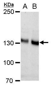 N-Cadherin antibody [N1N3] detects N-Cadherin protein by western blot analysis.A. 30 ug PC-12 whole cell extract B. 30 ug Rat2 whole cell extract5% SDS-PAGEN-Cadherin antibody [N1N3] (NBP2-19459) dilution: 1:1000 The HRP-conjugated anti-rabbit IgG antibody  was used to detect the primary antibody. 