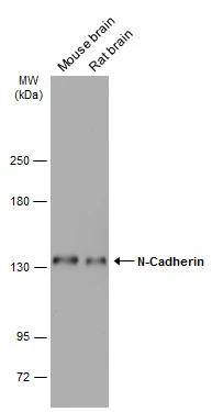 Various tissue extracts (50 ug) were separated by 5% SDS-PAGE, and the membrane was blotted with N-Cadherin antibody [N1N3] (NBP2-19459) diluted at 1:1000. The HRP-conjugated anti-rabbit IgG antibody  was used to detect the primary antibody. 