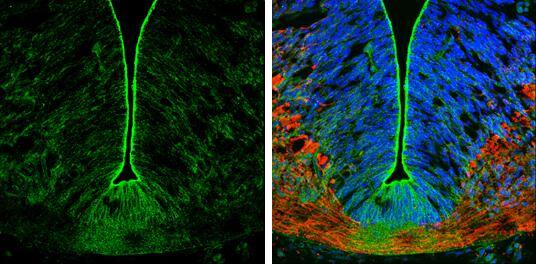 N-Cadherin antibody [N2C1], Internal detects N-Cadherin protein expression by immunohistochemical analysis.Sample: Frozen sectioned E13.5 Rat brain. Green: N-Cadherin protein stained by N-Cadherin antibody [N2C1], Internal (NBP2-19460) diluted at 1:250.Red: beta Tubulin 3/ TUJ1, a mature neuron marker, stained by beta Tubulin 3/ TUJ1 antibody [GT11710]  diluted at 1:500.Blue: Fluoroshield with DAPI . 
