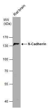 Rat tissue extract (50 ug) was separated by 7.5% SDS-PAGE, and the membrane was blotted with N-Cadherin antibody [N2C1], Internal (NBP2-19460) diluted at 1:1000. 