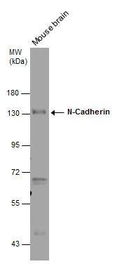 Mouse tissue extract (50 ug) was separated by 7.5% SDS-PAGE, and the membrane was blotted with N-Cadherin antibody [N2C1], Internal (NBP2-19460) diluted at 1:1000. 