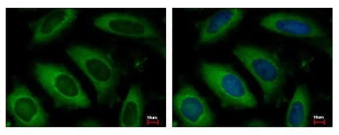 Immunocytochemistry/ Immunofluorescence NAA10 Antibody - Azide and BSA Free