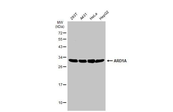 Various whole cell extracts (30 ug) were separated by 12% SDS-PAGE, and the membrane was blotted with ARD1A antibody (NBP2-19461) diluted at 1:1000. The HRP-conjugated anti-rabbit IgG antibody  was used to detect the primary antibody. 