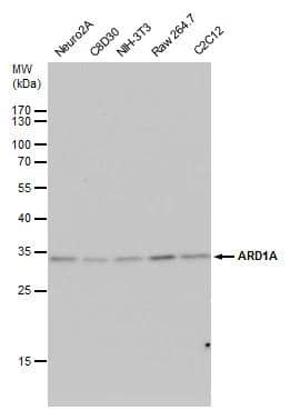 ARD1A antibody detects ARD1A protein by western blot analysis. Various whole cell extracts (30 ug) were separated by 12% SDS-PAGE, and blotted with ARD1A antibody (NBP2-19461) diluted by 1:1000. The HRP-conjugated anti-rabbit IgG antibody  was used to detect the primary antibody. 