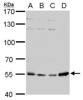 Visfatin antibody detects Visfatin protein by western blot analysis.A. 30 ug Jurkat whole cell lysate/extract B. 30 ug Raji whole cell lysate/extract C. 30 ug K562 whole cell lysate/extractD. 30 ug NCI-H929 whole cell lysate/extract7.5 % SDS-PAGEVisfatin antibody (NBP2-19468) dilution: 1:1000 