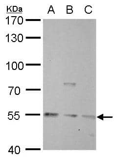 Visfatin antibody detects Visfatin protein by western blot analysis.A. 30 ug A549 whole cell lysate/extractB. 30 ug HCT116 whole cell lysate/extractC. 30 ug MCF-7 whole cell lysate/extract7.5 % SDS-PAGEVisfatin antibody (NBP2-19468) dilution: 1:1000 