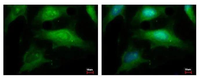 BRRN1 antibody [N1N2], N-term detects BRRN1 protein at cytoplasm and nucleus by immunofluorescent analysis. Sample: HeLa cells were fixed in ice-cold MeOH for 5 min.Green: BRRN1 protein stained by BRRN1 antibody [N1N2], N-term (NBP2-19483) diluted at 1:500.Blue: Hoechst 33342 staining. 