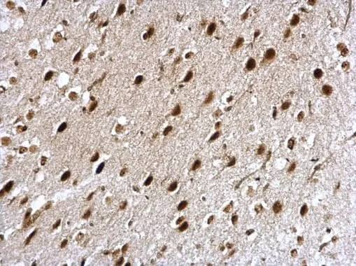 Immunohistochemistry: NCBP1 Antibody [NBP2-19484] - NCBP1 antibody [N1N2], N-term detects NCBP1 protein at nucleus on mouse fore brain by immunohistochemical analysis. Sample: Paraffin-embedded mouse fore brain. NCBP1 antibody [N1N2], N-term (NBP2-19484) dilution: 1:500.Antigen Retrieval: Trilogy™ (EDTA based, pH 8.0) buffer, 15min