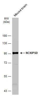 Mouse tissue extract (50 ug) was separated by 7.5% SDS-PAGE, and the membrane was blotted with NCKIPSD antibody [C1C3] (NBP2-19492) diluted at 1:1000. The HRP-conjugated anti-rabbit IgG antibody  was used to detect the primary antibody. 
