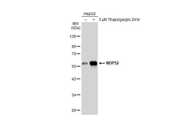 Western Blot: NDP52 Antibody [NBP2-19499] - Untreated (-) and treated (+) HepG2 whole cell extracts (30 ug) were separated by 10% SDS-PAGE, and the membrane was blotted with NDP52 antibody (NBP2-19499) diluted at 1:2000. The HRP-conjugated anti-rabbit IgG antibody  was used to detect the primary antibody.