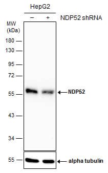<b>Genetic Strategies Validation. </b>Non-transfected (-) and transfected (+) HepG2 whole cell extracts (30 ug) were separated by 10% SDS-PAGE, and the membrane was blotted with NDP52 antibody (NBP2-19499) diluted at 1:4000. The HRP-conjugated anti-rabbit IgG antibody  was used to detect the primary antibody. 
