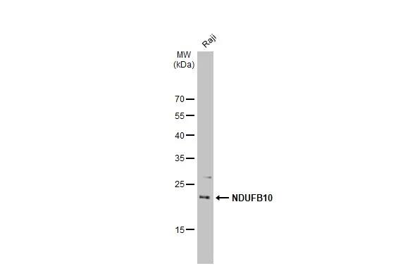 Western Blot: NDUFB10 Antibody [NBP2-19503] - Whole cell extract (30 ug) was separated by 12% SDS-PAGE, and the membrane was blotted with NDUFB10 antibody [N1C3] (NBP2-19503) diluted at 1:1000. The HRP-conjugated anti-rabbit IgG antibody  was used to detect the primary antibody, and the signal was developed with Trident ECL plus-Enhanced.