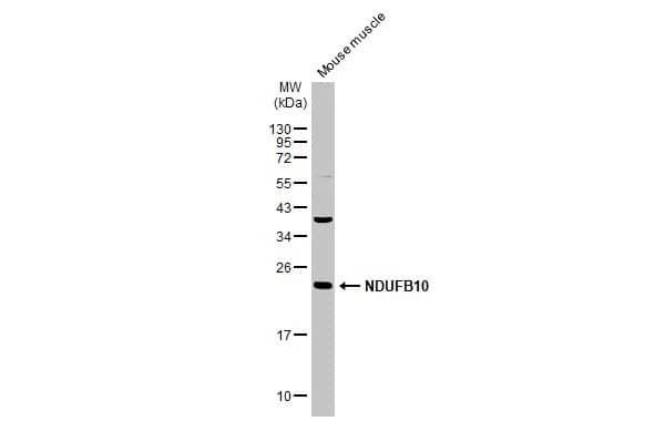 Western Blot: NDUFB10 Antibody [NBP2-19503] - Mouse tissue extract (50 ug) was separated by 12% SDS-PAGE, and the membrane was blotted with NDUFB10 antibody [N1C3] (NBP2-19503) diluted at 1:1000. The HRP-conjugated anti-rabbit IgG antibody  was used to detect the primary antibody, and the signal was developed with Trident ECL plus-Enhanced.