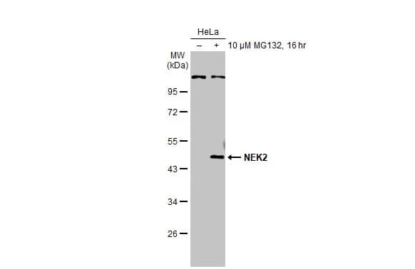 Western Blot: NEK2 Antibody [NBP2-19510] - Untreated (-) and treated (+) HeLa whole cell extracts (30 ug) were separated by 10% SDS-PAGE, and the membrane was blotted with NEK2 antibody (NBP2-19510) diluted at 1:1000. The HRP-conjugated anti-rabbit IgG antibody  was used to detect the primary antibody.