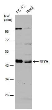 Various whole cell extracts (30 ug) were separated by 10% SDS-PAGE, and the membrane was blotted with NFYA antibody (NBP2-19533) diluted at 1:3000. The HRP-conjugated anti-rabbit IgG antibody  was used to detect the primary antibody. 