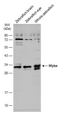 Western Blot: NFYB Antibody [NBP2-19535] - Various tissue extracts (30 ug) were separated by 12% SDS-PAGE, and the membrane was blotted with NFYB antibody (NBP2-19535) diluted at 1:1000. The HRP-conjugated anti-rabbit IgG antibody  was used to detect the primary antibody, and the signal was developed with Trident ECL plus-Enhanced.