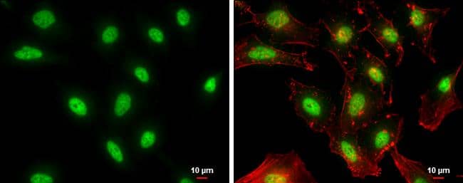 NFYB antibody detects NFYB protein at nucleus by immunofluorescent analysis.Sample: HeLa cells were fixed in 4% paraformaldehyde at RT for 15 min.Green: NFYB protein stained by NFYB antibody (NBP2-19535) diluted at 1:500.Red: Phalloidin, a cytoskeleton marker, diluted at 1:100.Scale bar = 10 um. 