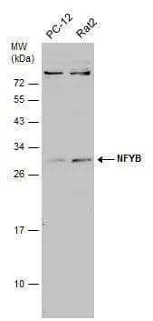 Various whole cell extracts (30 ug) were separated by 12% SDS-PAGE, and the membrane was blotted with NFYB antibody (NBP2-19535) diluted at 1:1000. The HRP-conjugated anti-rabbit IgG antibody  was used to detect the primary antibody. 