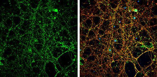 NMDAR2A antibody detects NMDAR2A protein by immunofluorescent analysis.Sample: DIV14 rat E18 primary cortical neurons were fixed in 4% paraformaldehyde at RT for 15 min.Green: NMDAR2A protein stained by NMDAR2A antibody (NBP2-19551) diluted at 1:500.Red: beta Tubulin 3/ Tuj1, stained by beta Tubulin 3/ Tuj1 antibody [GT1338]  diluted at 1:500.Blue: Fluoroshield with DAPI . 
