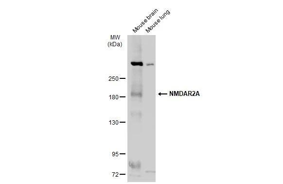 Various tissue extracts (50 ug) were separated by 5% SDS-PAGE, and the membrane was blotted with NMDAR2A antibody (NBP2-19551) diluted at 1:500. The HRP-conjugated anti-rabbit IgG antibody  was used to detect the primary antibody. 