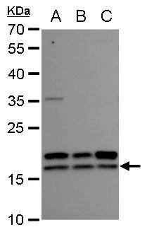 nm23-H2 antibody detects nm23-H2 protein by western blot analysis.A. 30 ug A549 whole cell extract B. 30 ug H1299 whole cell extract C. 30 ug HCT116 whole cell extract12 % SDS-PAGEnm23-H2 antibody (NBP2-19552) dilution: 1:1000 