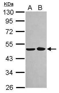 Sample (30 ug of whole cell lysate)  A: A431  B: Jurkat  10% SDS PAGE  NBP2-19558 diluted at 1:1000  