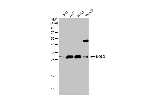 Western Blot: ARC/NOL3 Antibody [NBP2-19561] - Various whole cell extracts (30 ug) were separated by 12% SDS-PAGE, and the membrane was blotted with ARC/NOL3 antibody (NBP2-19561) diluted at 1:1000. The HRP-conjugated anti-rabbit IgG antibody  was used to detect the primary antibody.