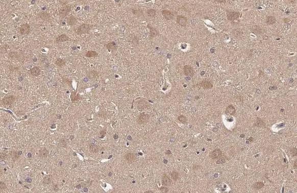 Immunohistochemistry-Paraffin: ARC/NOL3 Antibody [NBP2-19561] - ARC/NOL3 antibody detects ARC/NOL3 protein at nucleus by immunohistochemical analysis.Sample: Paraffin-embedded rat brain.ARC/NOL3 stained by ARC/NOL3 antibody (NBP2-19561) diluted at 1:500.Antigen Retrieval: Citrate buffer, pH 6.0, 15 min