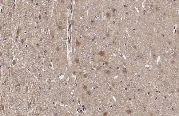 Immunohistochemistry-Paraffin: ARC/NOL3 Antibody [NBP2-19561] - ARC/NOL3 antibody detects ARC/NOL3 protein at nucleus by immunohistochemical analysis.Sample: Paraffin-embedded mouse brain.ARC/NOL3 stained by ARC/NOL3 antibody (NBP2-19561) diluted at 1:500.Antigen Retrieval: Citrate buffer, pH 6.0, 15 min