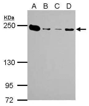 MYH9 antibody [N1], N-term detects MYH9 protein by Western blot analysis.A. 30 ug U87-MG whole cell lysate/extract B. 30 ug SK-N-SH whole cell lysate/extract C. 30 ug IMR32 whole cell lysate/extract D. 30 ug SK-N-AS whole cell lysate/extract 5 % SDS-PAGEMYH9 antibody [N1], N-term (NBP2-19563) dilution: 1:1000 