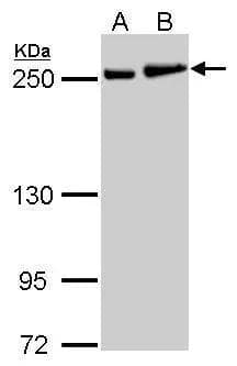 MYH9 antibody [N1], N-term detects MYH9 protein by Western blot analysis.A. 30 ug NT2D1 whole cell lysate/extract B. 30 ug PC-3 whole cell lysate/extract 5 % SDS-PAGEMYH9 antibody [N1], N-term (NBP2-19563) dilution: 1:1000 