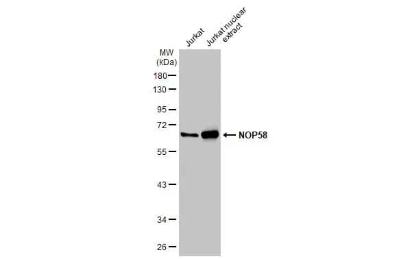 Western Blot: NOP58 Antibody [NBP2-19564] - Jurkat whole cell and nuclear extracts (30 ug) were separated by 10% SDS-PAGE, and the membrane was blotted with NOP58 antibody [N1N3] (NBP2-19564) diluted at 1:1000. The HRP-conjugated anti-rabbit IgG antibody  was used to detect the primary antibody.