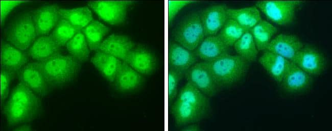 NR1D1 antibody detects NR1D1 protein at cytoplasm and nucleus by immunofluorescent analysis.Sample: A431 cells were fixed in 4% paraformaldehyde at RT for 15 min.Green: NR1D1 protein stained by NR1D1 antibody (NBP2-19574) diluted at 1:400.Blue: Hoechst 33342 staining. 