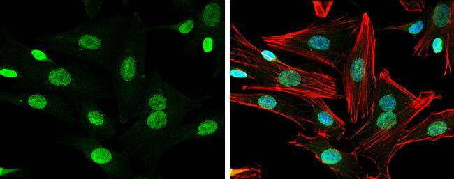 Neuregulin-1 antibody detects Neuregulin-1 protein at nucleus by immunofluorescent analysis.Sample: SK-N-SH cells were fixed in 4% paraformaldehyde at RT for 15 min.Green: Neuregulin-1 protein stained by Neuregulin-1 antibody (NBP2-19587) diluted at 1:500.Red: Phalloidin, a cytoskeleton marker, diluted at 1:100.Blue: Hoechst 33342 staining. 
