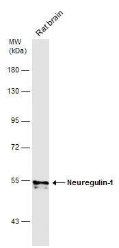Rat tissue extract (50 ug) was separated by 7.5% SDS-PAGE, and the membrane was blotted with Neuregulin-1 antibody (NBP2-19587) diluted at 1:1000. The HRP-conjugated anti-rabbit IgG antibody  was used to detect the primary antibody. 