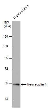 Human tissue extract (30 ug) was separated by 7.5% SDS-PAGE, and the membrane was blotted with Neuregulin-1 antibody (NBP2-19587) diluted at 1:1000. The HRP-conjugated anti-rabbit IgG antibody  was used to detect the primary antibody. 