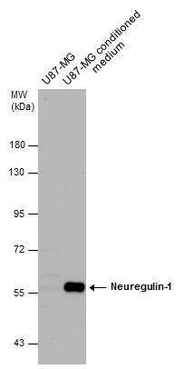 U87-MG whole cell extract and conditioned medium (30 ug) were separated by 7.5% SDS-PAGE, and the membrane was blotted with Neuregulin-1 antibody (NBP2-19587) diluted at 1:1000. The HRP-conjugated anti-rabbit IgG antibody  was used to detect the primary antibody. 