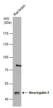 Rat tissue extract (50 ug) was separated by 7.5% SDS-PAGE, and the membrane was blotted with Neuregulin-1 antibody [C1C3] (NBP2-19588) diluted at 1:2000. 