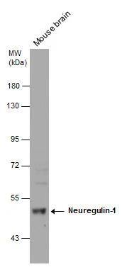 Mouse tissue extract (50 ug) was separated by 7.5% SDS-PAGE, and the membrane was blotted with Neuregulin-1 antibody [C1C3] (NBP2-19588) diluted at 1:2000. 