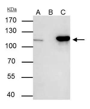 NUP107 antibody immunoprecipitates NUP107 protein in IP experiments. IP Sample: 293T whole cell lysate/extract A : 30 ug whole cell lysate/extract of NUP107 protein expressing 293T cells B : Control with 3 ug of pre-immune rabbit IgG C : Immunoprecipitation of NUP107 by 3 ug of NUP107 antibody (NBP2-19602) 7.5% SDS-PAGE The immunoprecipitated NUP107 protein was detected by NUP107 antibody (NBP2-19602) diluted at 1 : 500. EasyBlot anti-rabbit IgG (HRP)  was used as a secondary reagent. 