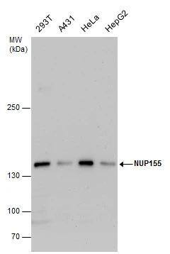 Western Blot NUP155 Antibody - BSA Free